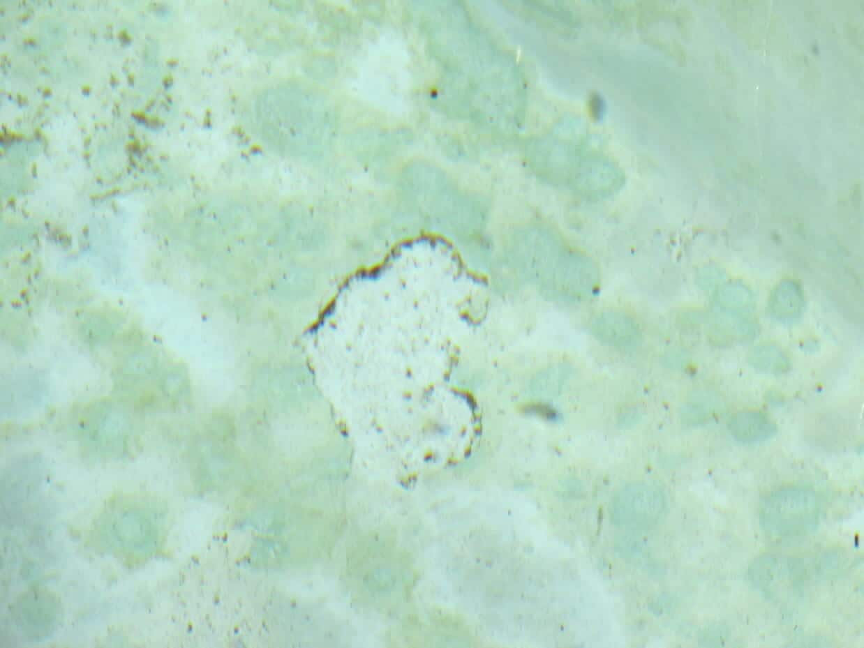 Plaster Flaking Or Cracked On Swimming Pools and Spas